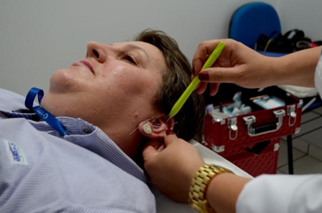 Tratamento com acupuntura  a mais nova  conquista dos trabalhadores em cooperativas