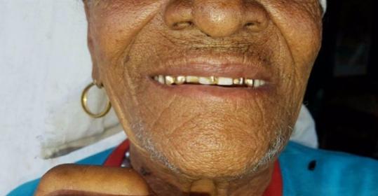 Rapaz tenta roubar dentadura de ouro da av de 81 anos em Sarandi
