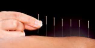 Entenda o que é acupuntura e quais suas indicações