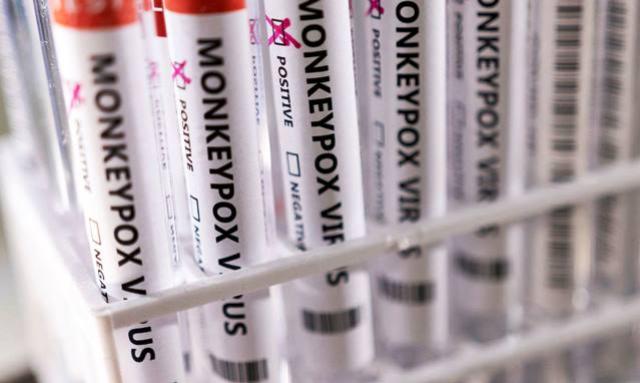 Saúde Ministério da Saúde confirma 8º caso de varíola dos macacos no país