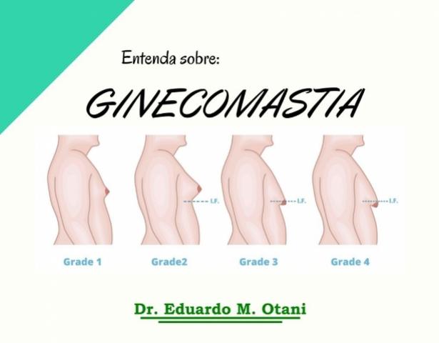 Dr. Eduardo M. Otani explica sobre Ginecomastia