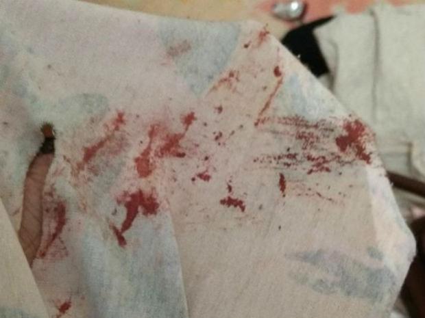 Jovem do Paran diz ter sido atacada por homem com seringa cheia de sangue