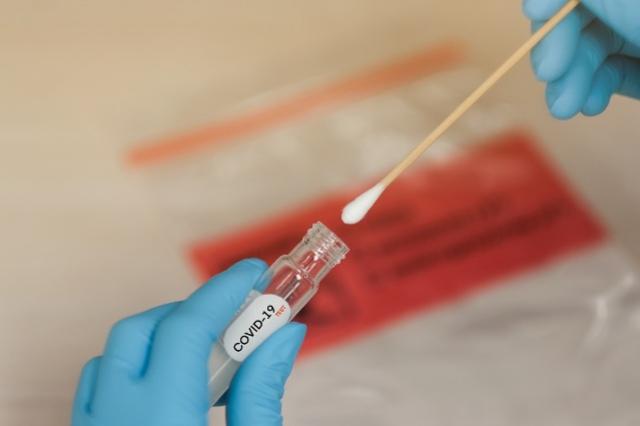 Procon de Goioerê notifica Laboratórios por preços em exames de covid-19