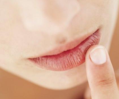 Lábios ressecados: o que fazer para melhorá-los?