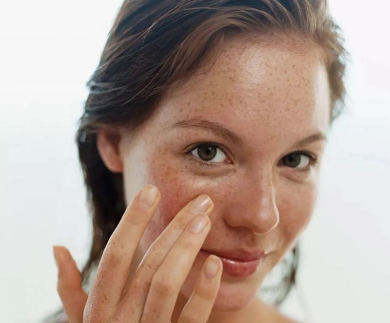 6 hábitos de cuidados com a pele para evitar e reduzir manchas